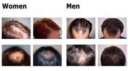 Organic Hair Growth Essence - My Store
